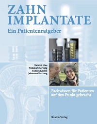 Schallzahnbürste Test - Schallzahnbürsten bei amazon kaufen Testsieger die besten Schall Zahnbürsten Panasonic Happy Brush Schallzahnbürste Test - Schallzahnbürsten bei amazon kaufen Testsieger die besten Schall Zahnbürsten Panasonic Happy Brush