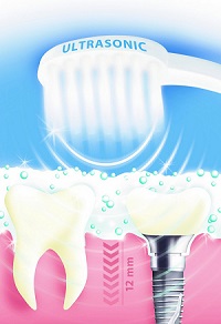 Philips sonicare Diamondclean Zahnbürste bei amazon kaufen und Test Schallzahnbürste Flexcare Platinum Ersatzzahnbürsten healthy white airfloss Philips sonicare Diamondclean Zahnbürste bei amazon kaufen und Test Schallzahnbürste Flexcare Platinum Ersatzzahnbürsten healthy white airfloss
