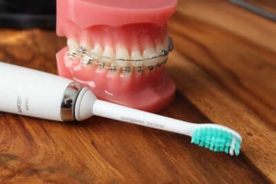 Zahnfleischentzündung -Feste Zahnspange putzen mit Schallzahnbürste