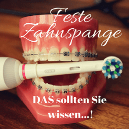 Feste Zahnspange - Spange - Brackets - superelastische Bögen - iGeL - Keramikbrackets