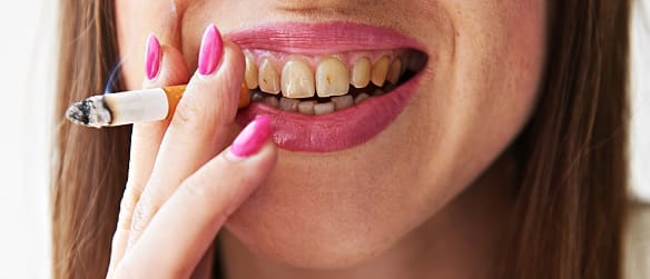 Schlechte Zähne durch Rauchen - Blutblase im Mund