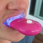 Diamond Smile Home Bleaching Test- Zähne selber aufhellen