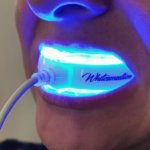 Whitesensation Phone Home Bleaching Test - LED Lampe mit Anschluss ans Smartphone