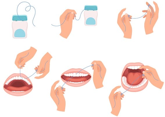 Zahnseide richtig anwenden - Schritt für Schritt Anleitung
